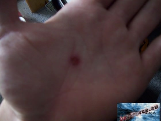 meine hand